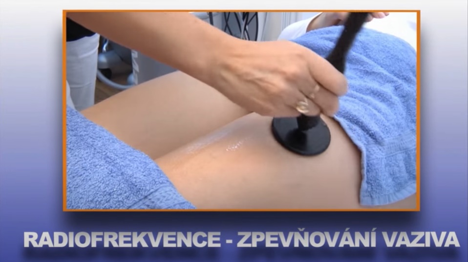 Foto RAdiofrekvence.jpg